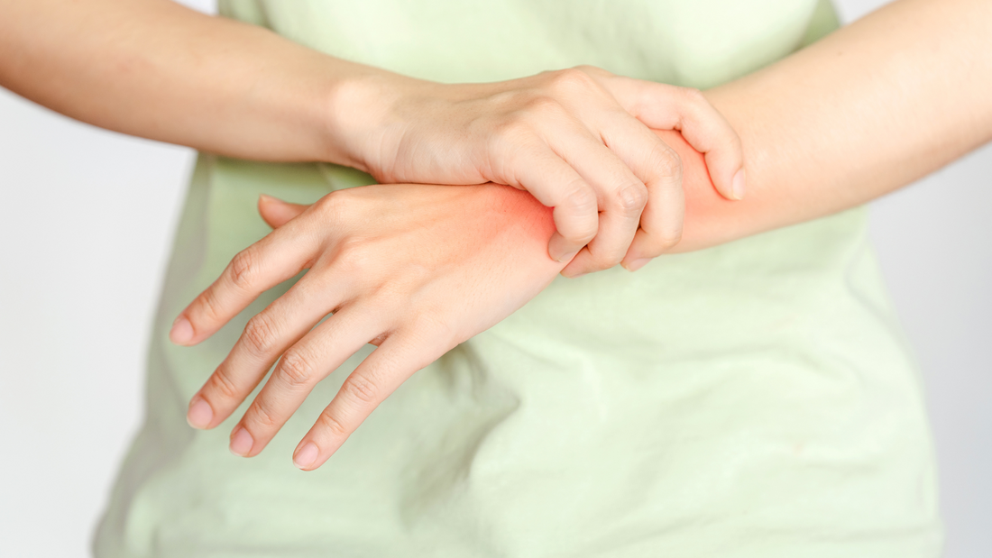 Person holding painful red inflamed wrist symptom of rheumatoid arthritis