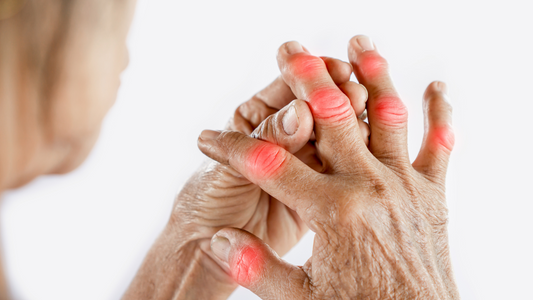 elderly hands with red inflamed joints showing arthritis effects and pain